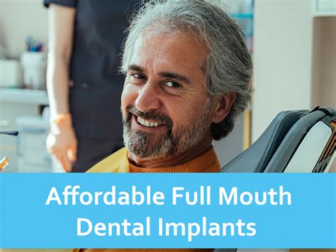 affordable local full mouth dental implants in my area
